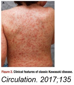 圖2圖片說明皮疹Circulation2017135